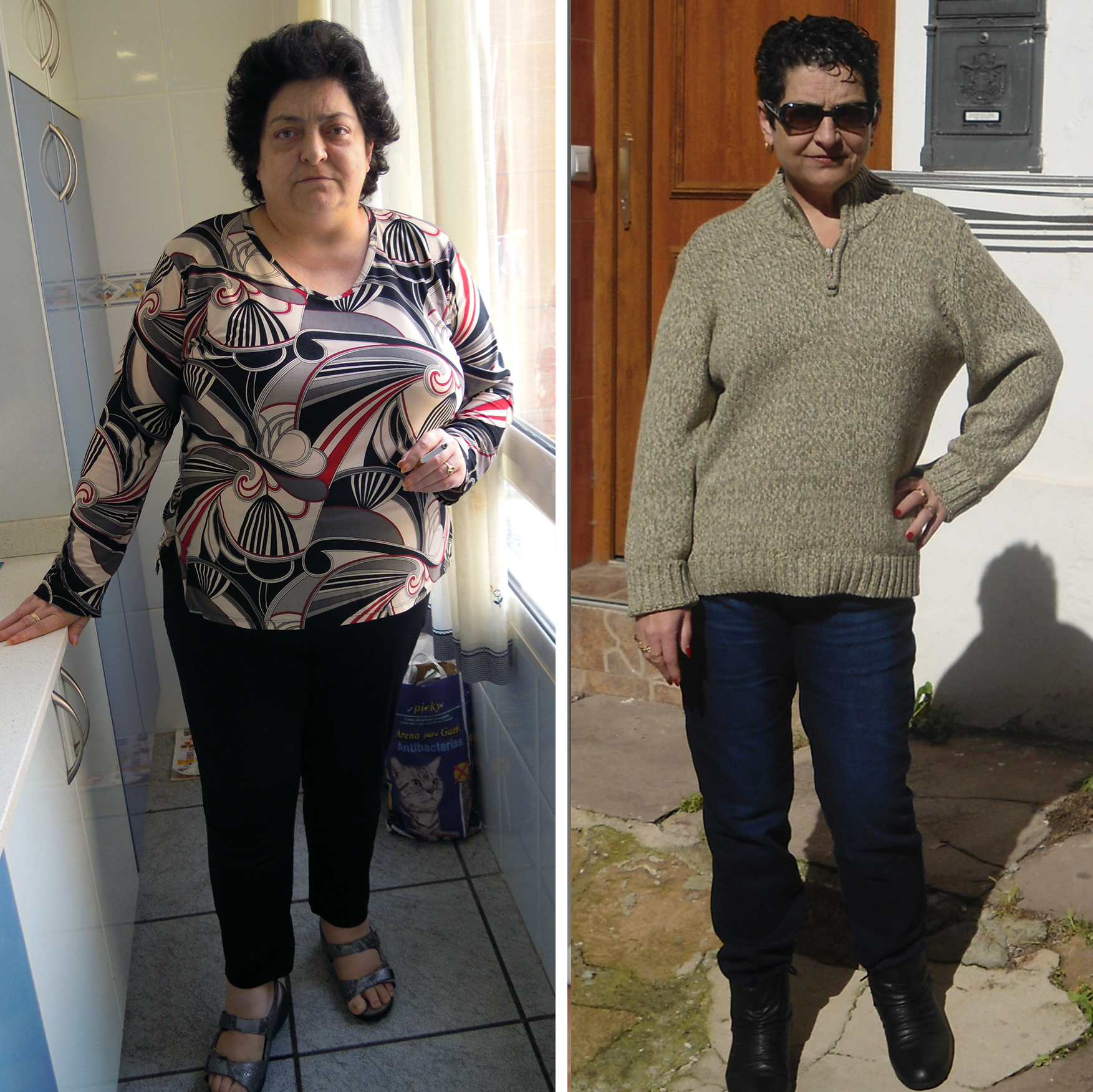 Isabel Díaz, 16 meses después de la operación por laparoscopia