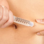 Diabetes Tipo II y la opción quirúrgica