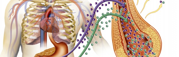 “No sabía que la diabetes Tipo II puede solucionarse con cirugía”