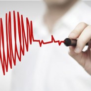 La cirugía de derivación gástrica reduce el riesgo de infarto de miocardio y otras enfermedades