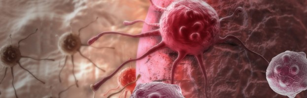 Día Mundial del Cáncer. Las cifras del cáncer en España