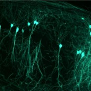 Sufrir diabetes e hipertensión puede conducir a la pérdida de células cerebrales