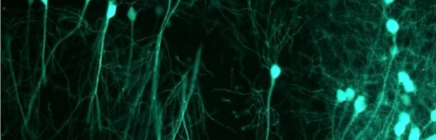 Sufrir diabetes e hipertensión puede conducir a la pérdida de células cerebrales