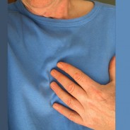 Las personas con diabetes son más propensas a fallecer tras un ataque cardiaco