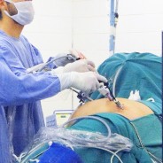 Nuevo estudio confirma la capacidad de la cirugía bariátrica para detener la diabetes tipo II