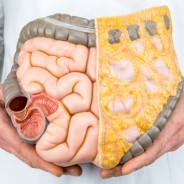 La extirpación del colon está relacionada con un mayor número de diabetes