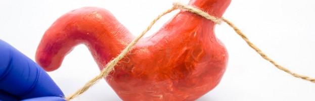 Cirugía bariátrica reduce en 40 % el riesgo de padecer de enfermedad coronaria